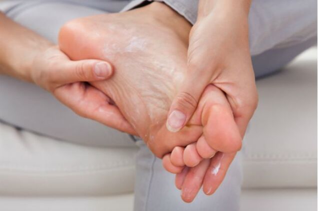 Antifungal creams and drops will help in the initial stages of toenail fungus