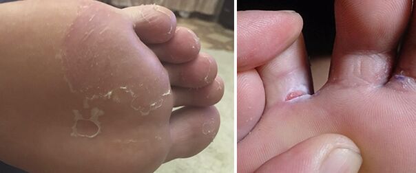 Fingers