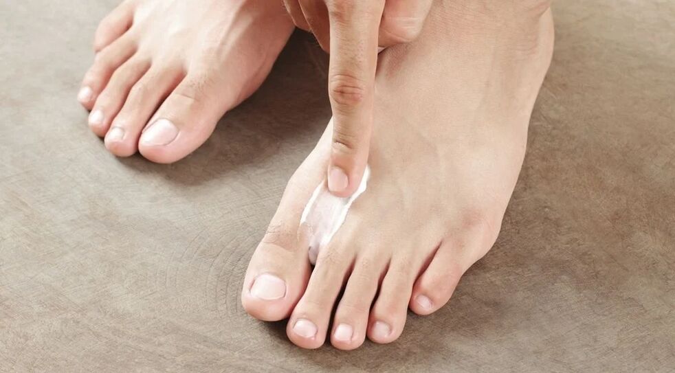 Application of fungus cream between fingers