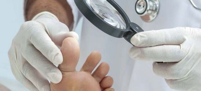 Examinations before the start of fungal treatment