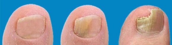 The process of fungal development