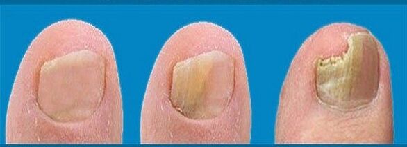 the process of fungal development